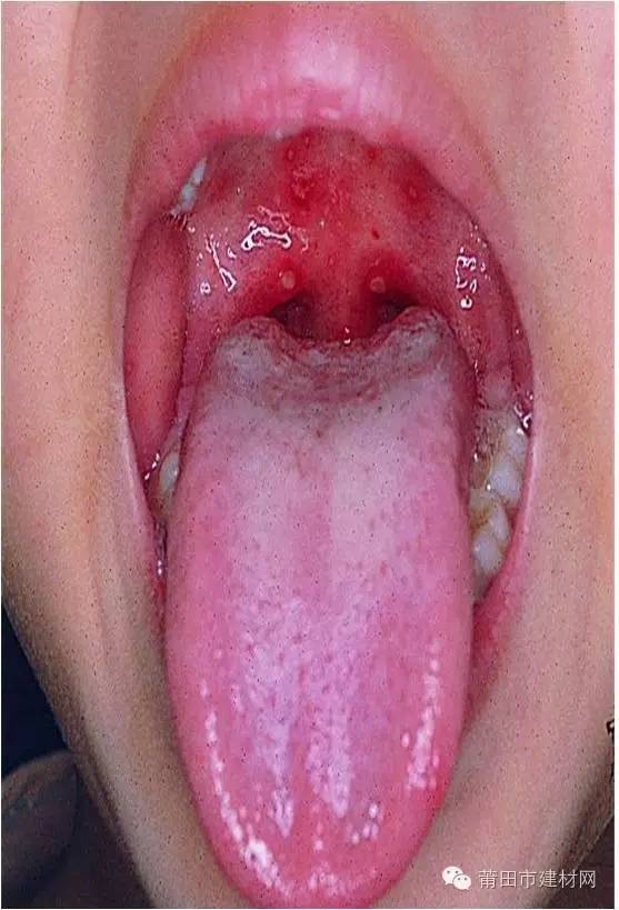 1465283541456309.jpg 0 (3).jpg